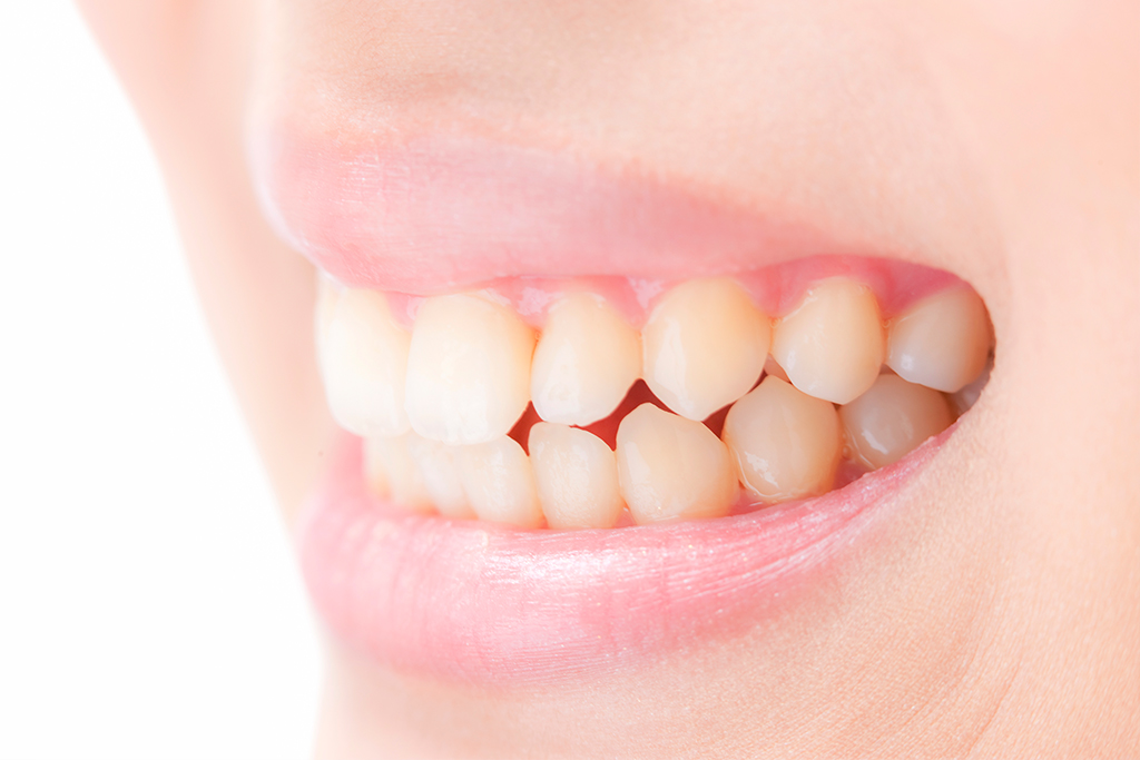 神保町・神保町ガーデン歯科・歯ぎしり・食いしばり