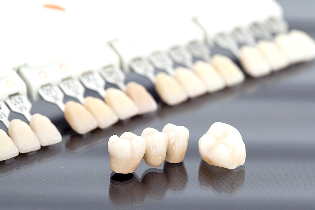 神保町・神保町ガーデン歯科・審美治療