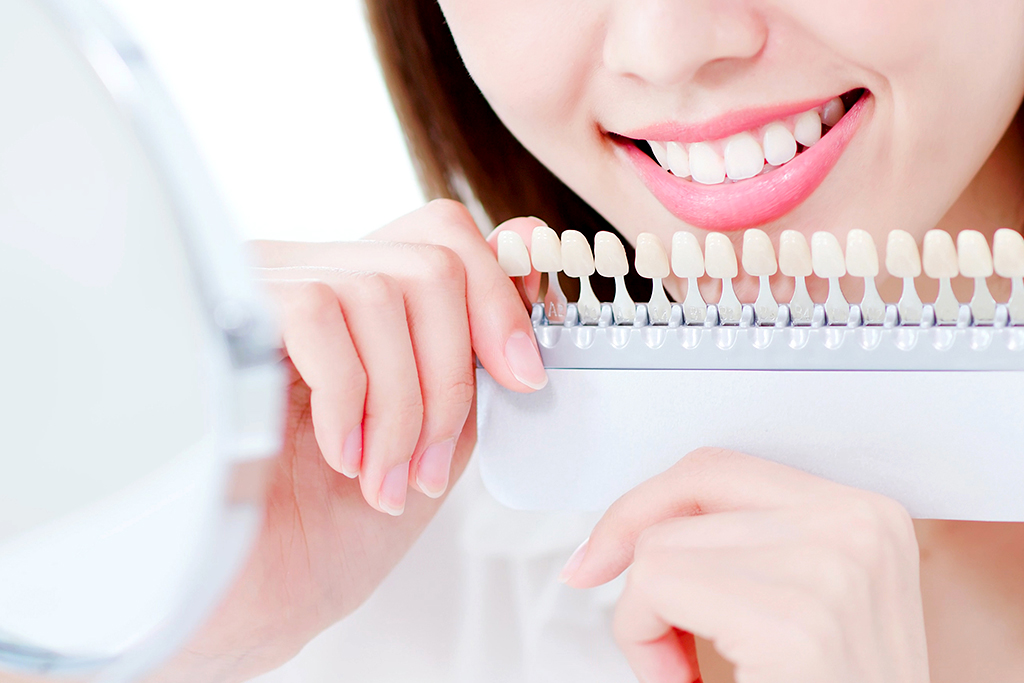 神保町・神保町ガーデン歯科・ホワイトニング