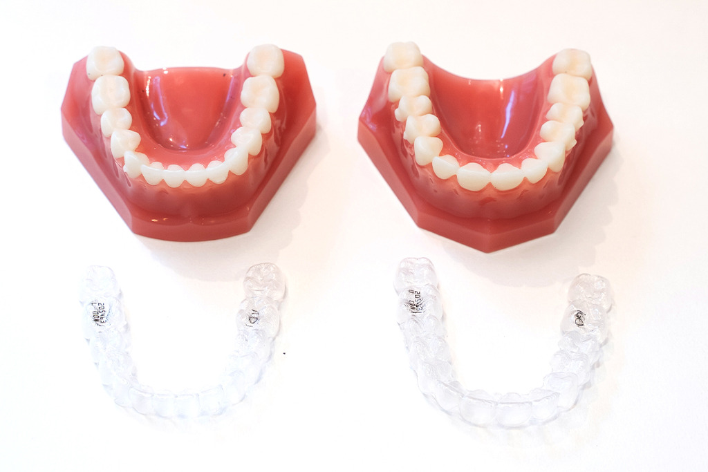 神保町・神保町ガーデン歯科・透明で目立ちにくいマウスピース型矯正装置