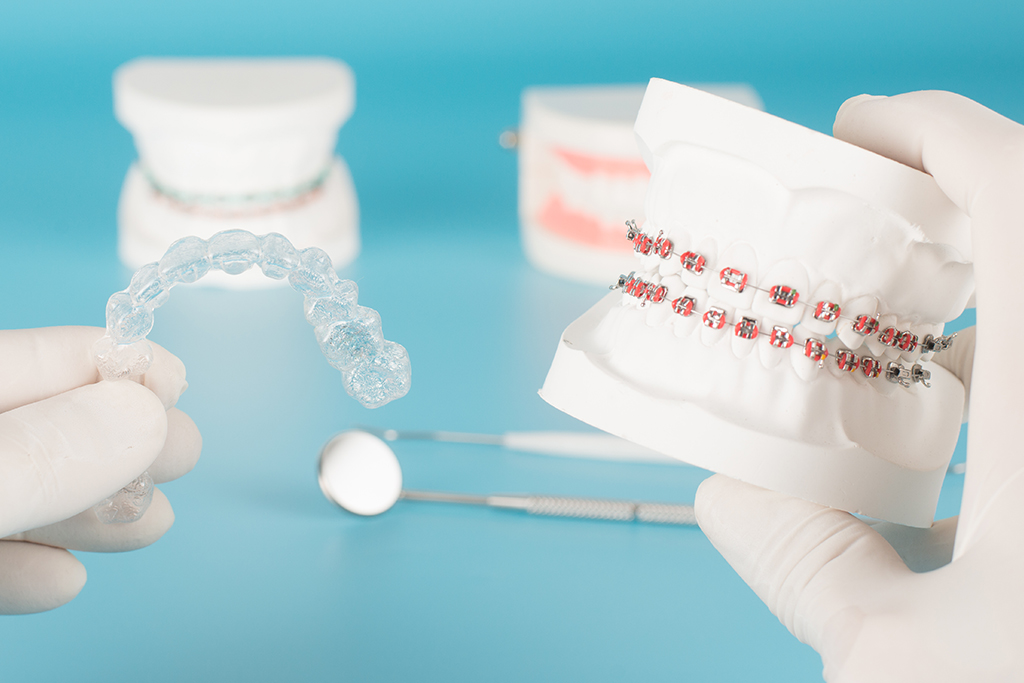 神保町・神保町ガーデン歯科・矯正治療